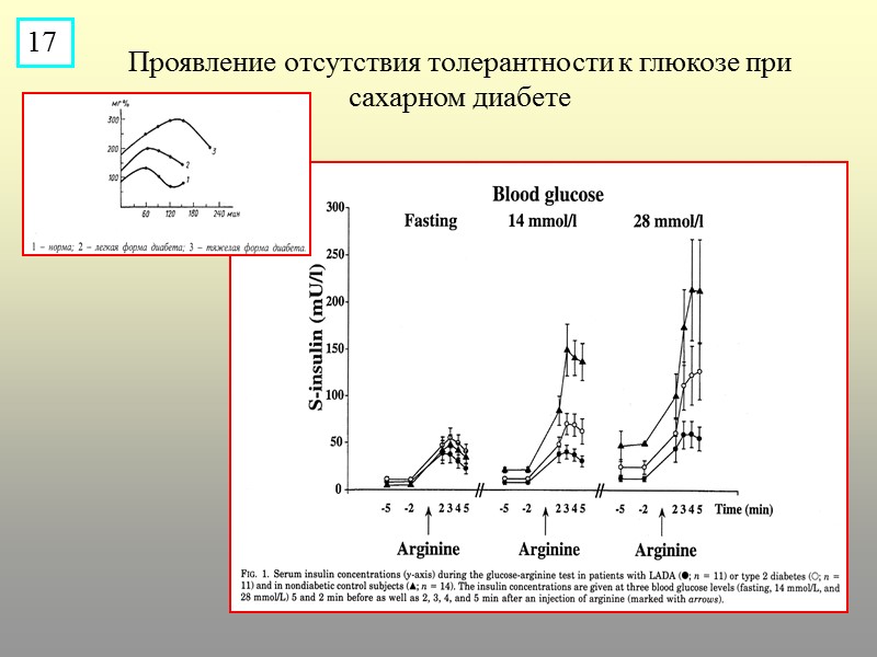 Проявление отсутствия толерантности к глюкозе при сахарном диабете 17